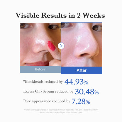 Zero Pore Pad 2.0